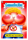 Pete Nut Allergy