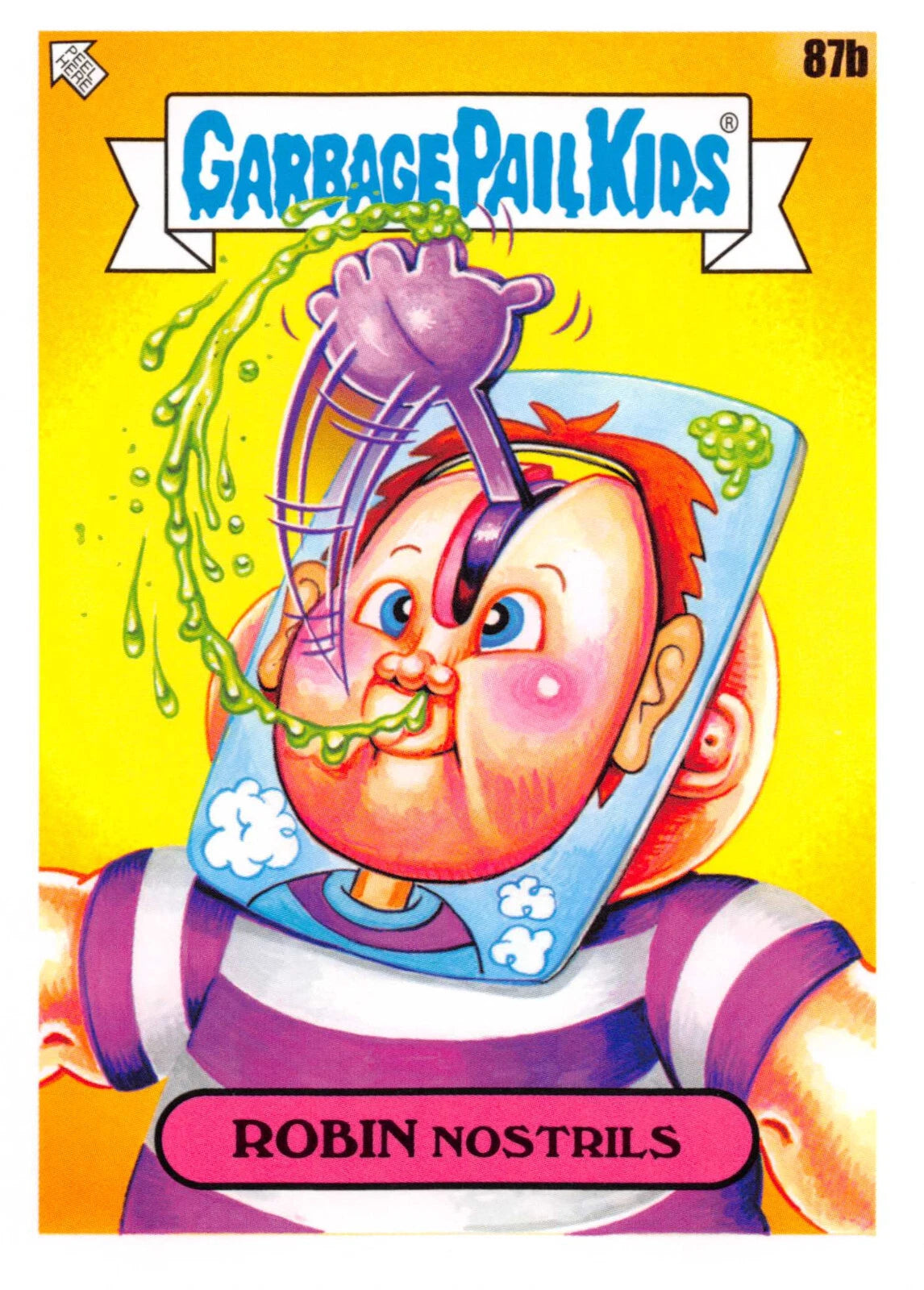 Robin Nostrils